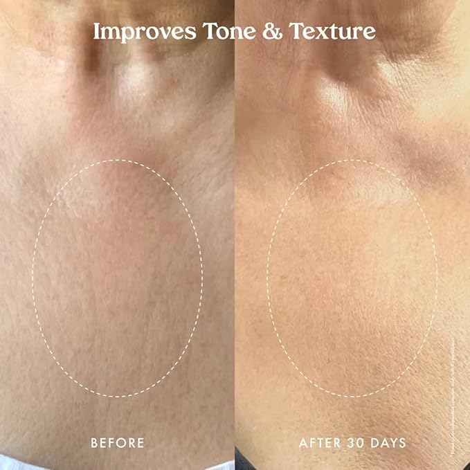 Kopari Ultra Restore Firming Body Serum with Dual Peptide Complex, Deeply Hydrates, Improves Skin Tone & Texture, Firms & Enhances Elasticity, 5 oz