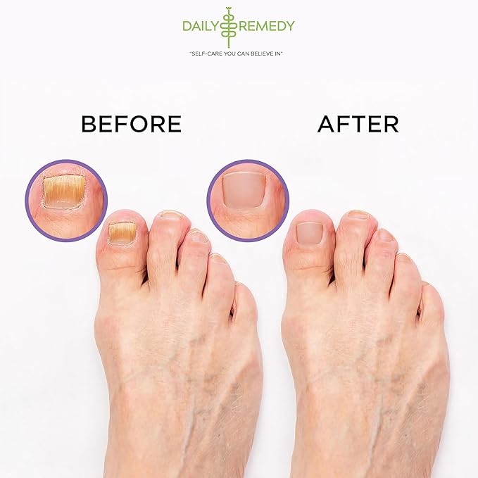 Calming Lavender Foot Soak with Epsom Salt, Made in USA, Foot Soak Soothes Tired Feet, Athletes Foot, Stubborn Foot Odor, Softens Calluses & Helps Treat Toenail, 16 oz 1 lb