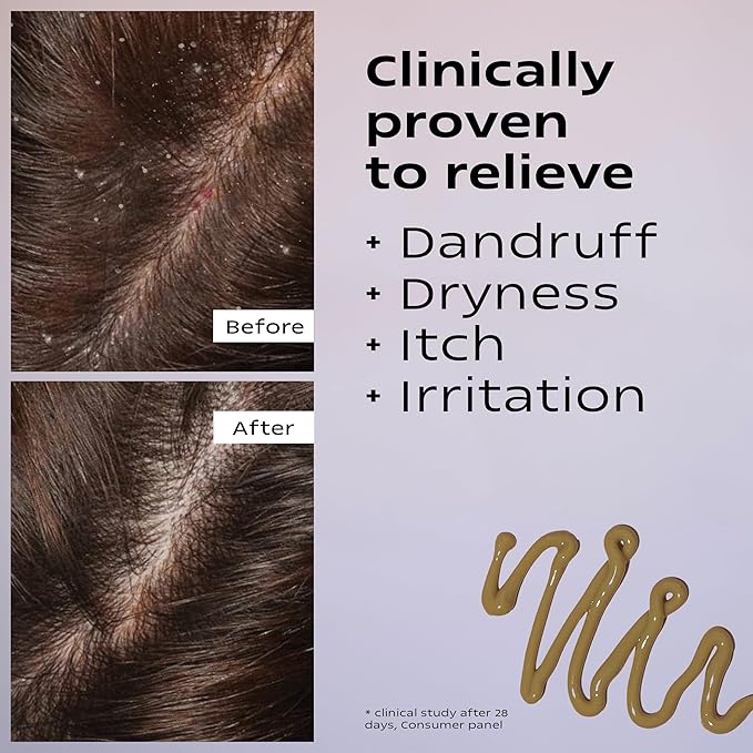 KAMEDIS Scalp Moisturizer Lotion For Dry, Itchy, Dandruff, Flaky, Seborrheic Dermatitis, Psoriasis and Sensitive Scalp. Over-Night Mask Treatment Botanicals-Based. Parabens Free. 3.38 Fl Oz.