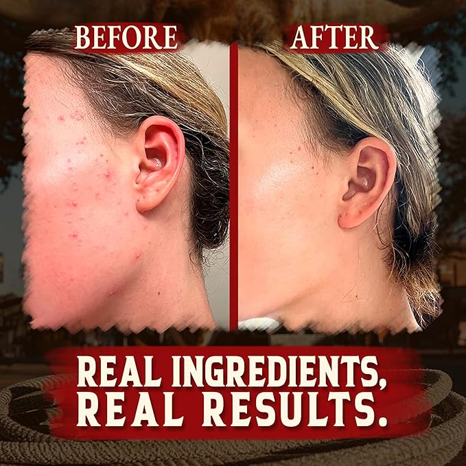 Organic Beef Tallow for Skin - 2OZ (Unscented, Concentrated) — Grass Fed Beef Tallow for face + Body — US-Made Tallow and Honey Balm Moisturizer for Dry & Sensitive Skin, Eczema, Rosacea(No Additives)