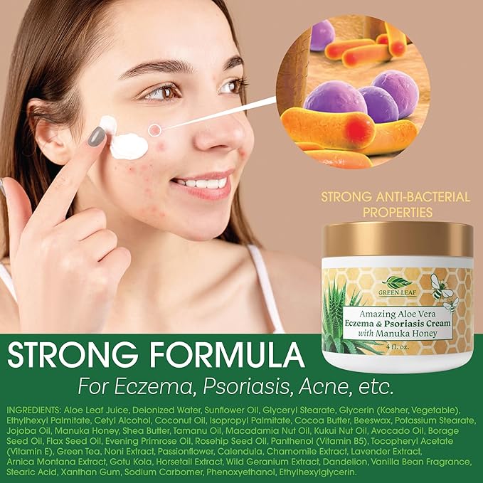 Manuka Honey Eczema Cream Moisturizing Lotion Treatment for Psoriasis Relief - Itchy, Dry Skin Rash Ointment - Soothing Moisturizer for Baby, Kids, Adults - High Strength Body & Face Cream 2oz